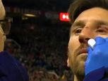 ميسي يرتدي قناعاً في مباراة الإياب ضد مانشستر يونايتد بدوري الأبطال