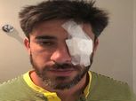 بالفيديو| لاعب بوكا جونيورز يتعرض لإصابة خطيرة في عينه