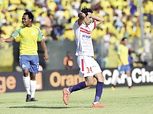 صانع ألعاب الزمالك يجري أشعة على القدم اليوم