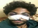 بالصور| إصابة خطيرة لمدافع فريق شباب «الأهلي»