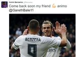 نجم ريال مدريد يجري جراحة ناجحة