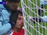 إصابة دموية خطيرة لـ كاي هافرتز لاعب آرسنال في لقاء إنتر ميلان بدوري الأبطال