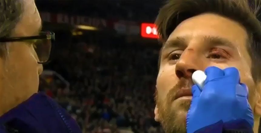 ميسي يرتدي قناعاً في مباراة الإياب ضد مانشستر يونايتد بدوري الأبطال