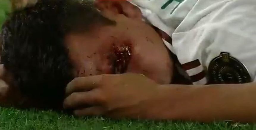 إصابة مرعبة لـ هرفينج لوزانو لاعب المكسيك في الكأس الذهبية «فيديو»
