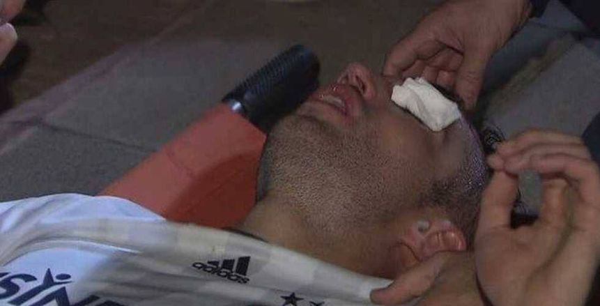 زوجة فان بيرسي عن إصابته: "يشبه الملاكمين"