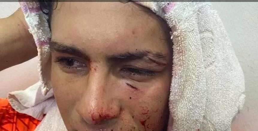 «حرب شوارع» بين ناشئي الترسانة وأبو قير بدوري المحترفين.. كسور وإصابات بالغة