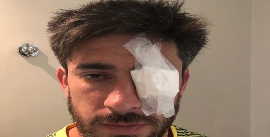 بالفيديو| لاعب بوكا جونيورز يتعرض لإصابة خطيرة في عينه