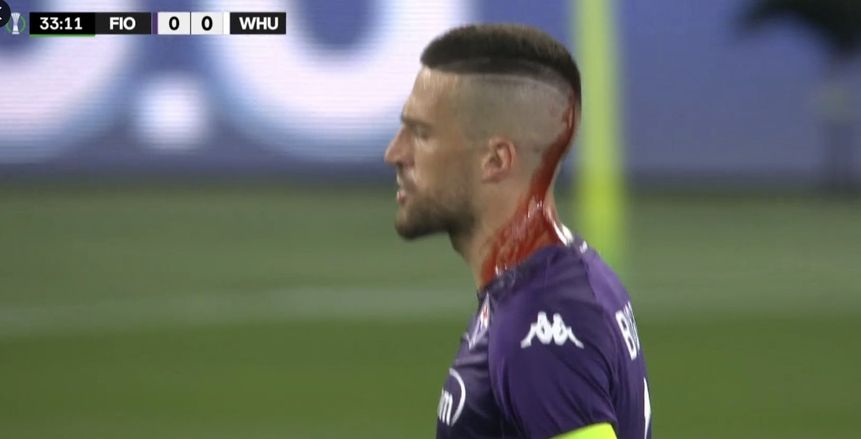 جماهير وست هام تعتدي على لاعب فيورنتينا بنهائي دوري المؤتمر الأوروبي «فيديو»