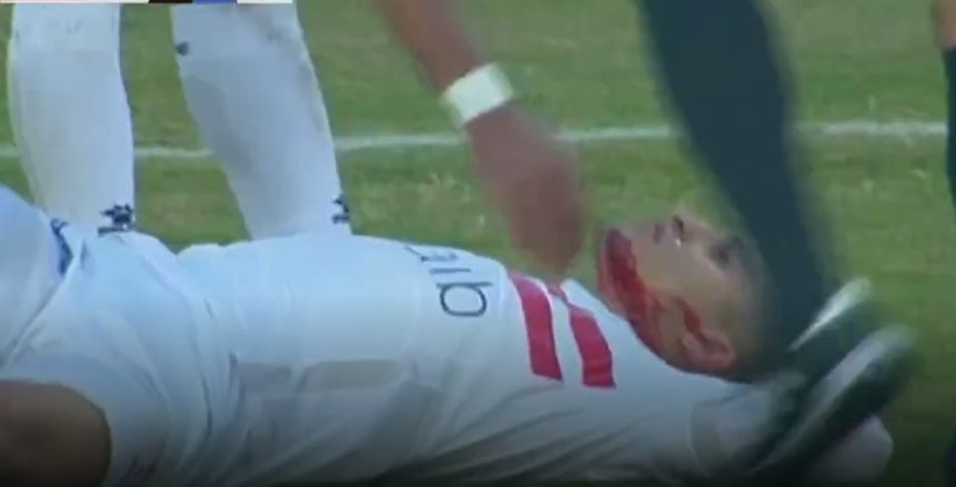 الإصابات تضرب الأهلي والزمالك والمصري والمحلة: 12 غرزة وكسر بالجمجمة