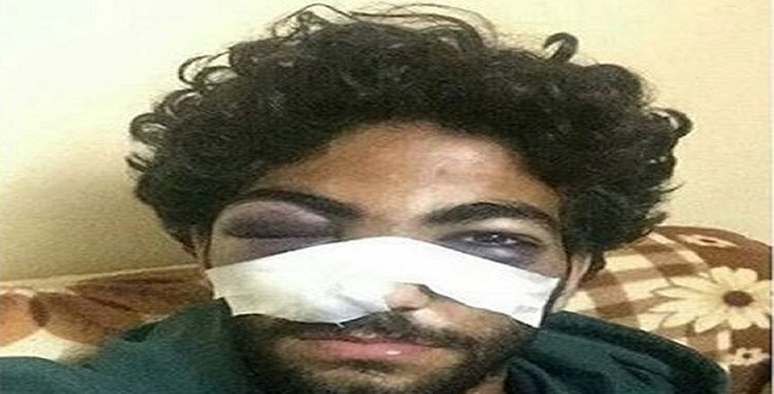 بالصور| إصابة خطيرة لمدافع فريق شباب «الأهلي»