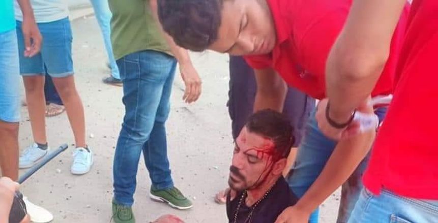 شقيق عمرو زكي يروي تفاصيل الحادث: حالته حرجة وادعوا له بالشفاء