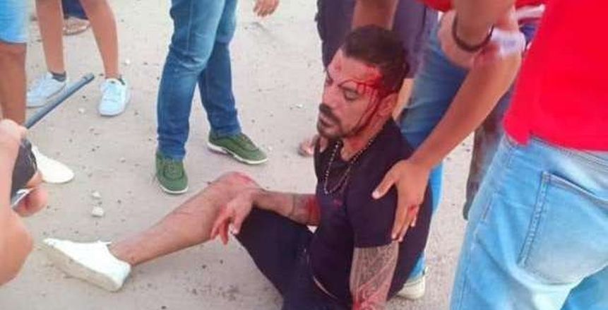 شقيق عمرو زكي: الحمدلله بدأ يتكلم ومستنيين نطمئن على الجرح